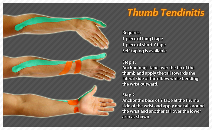 ares clinical taping - rheumatism thumb