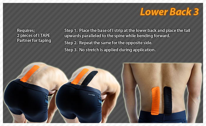 Lower back pain - Kinesiology tape